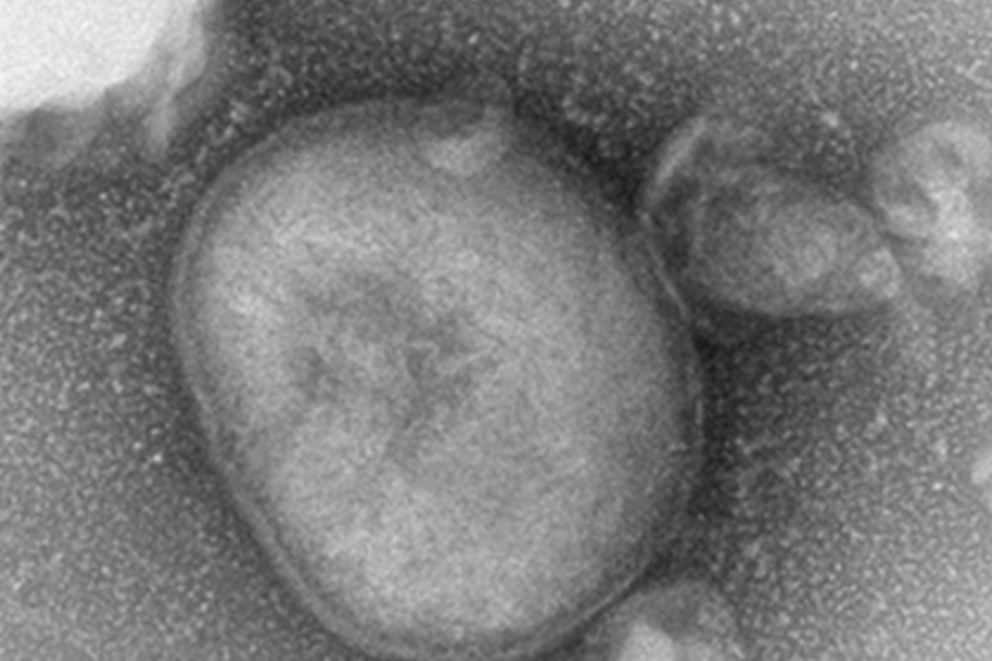 LSD Virus
